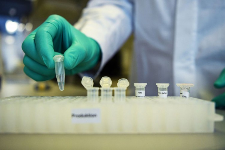 Estado já confirma 1.240.117 casos de Covid-19 desde o início da pandemia