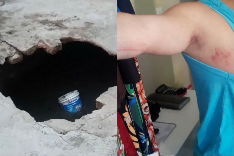 O rapaz sofreu escoriações leves