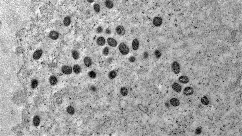 A Mpox pertence ao gênero orthopoxvirus