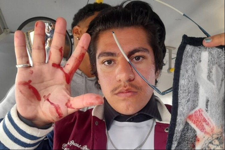 Vitor Cotrim, aluno atingido por estilhaços de vidro após pedra jogada por bolsonaristas