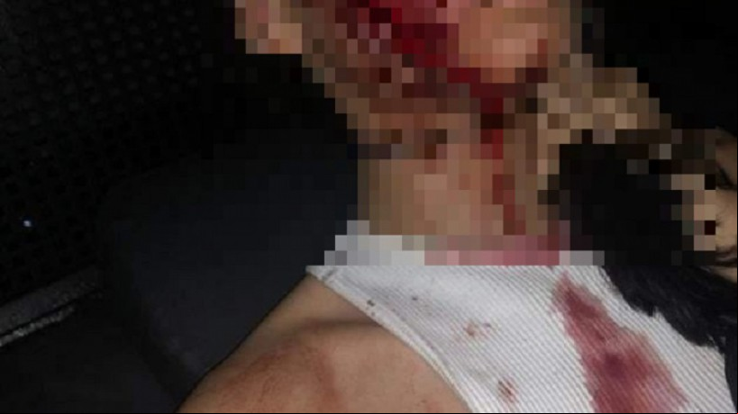 Fotos mostram ferimentos gerados pelas agressões praticadas