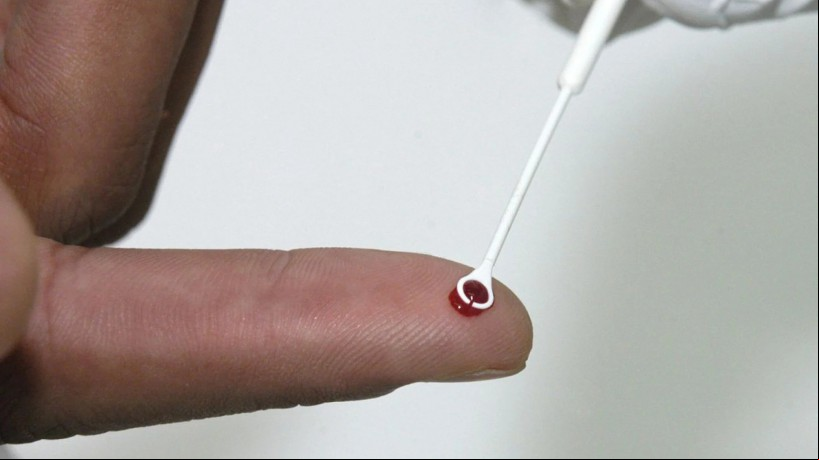 Medula óssea recebida por paciente não possui uma mutação já detectada por cientistas, que consegue bloquear o vírus da Aids