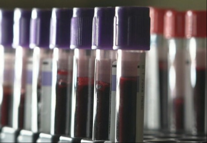 Segundo o laboratório, foi aberta uma sindicância interna para investigar o caso.