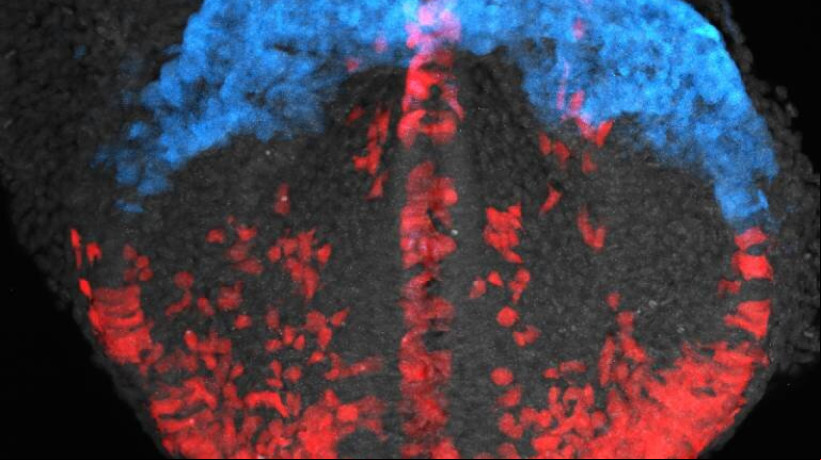 Os cientistas marcaram as células do músculo cardíaco para que brilhassem em diferentes cores, e dessa forma, podessem observar sua organização 
