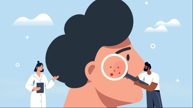 O cÃ¢ncer de pele Ã© uma doenÃ§a silenciosa e agressiva (Imagem: mentalmind | Shutterstock) 