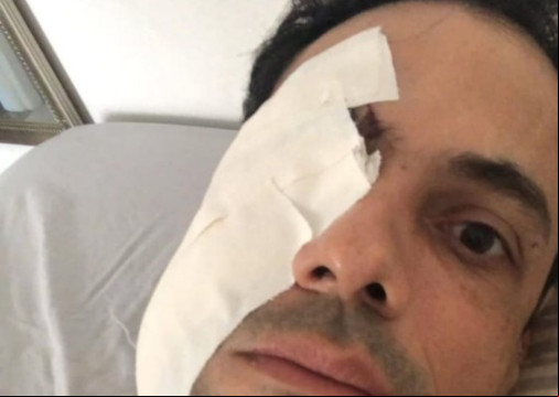O empresÃ¡rio Bruno Rugue foi agredido enquanto trabalhava em um evento. A PolÃ­cia Civil investiga o caso 