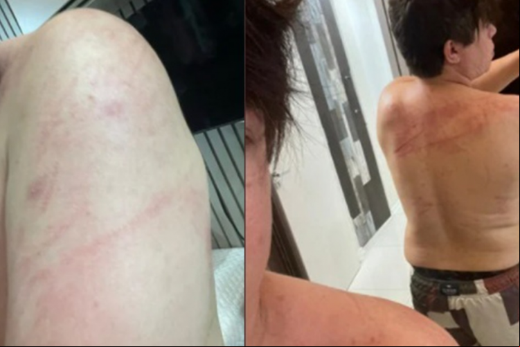 DJ Ivis Araújo aparece ferido com arranhões em fotos